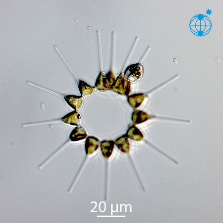 Asterionellopsis glacialis © Alfred Wegener Institute for Polar and Marine Research