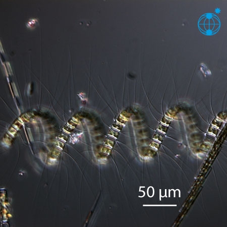 Chaetoceros debilis © Alfred Wegener Institute for Polar and Marine Research