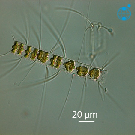Chaetoceros didymus © Alfred Wegener Institute for Polar and Marine Research