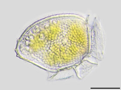Dinophysis © Alfred Wegener Institute for Polar and Marine Research
