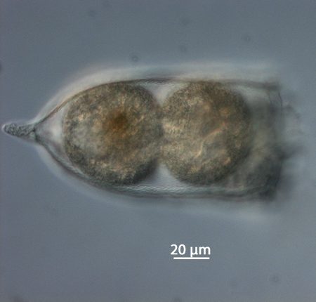 Favella ehrenbergii a une forme de cloche © Alfred Wegener Institute for Polar and Marine Research