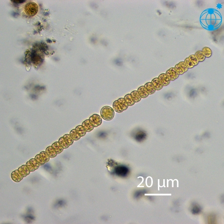 Une cyanobactérie, Alexandra anabaena © Alfred Wegener Institute for Polar and Marine Research