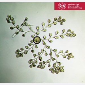 Zoothamnium alternans © Alfred Wegener Institute for Polar and Marine Research