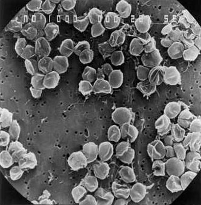 Pyrococcus abyss © Ifremer