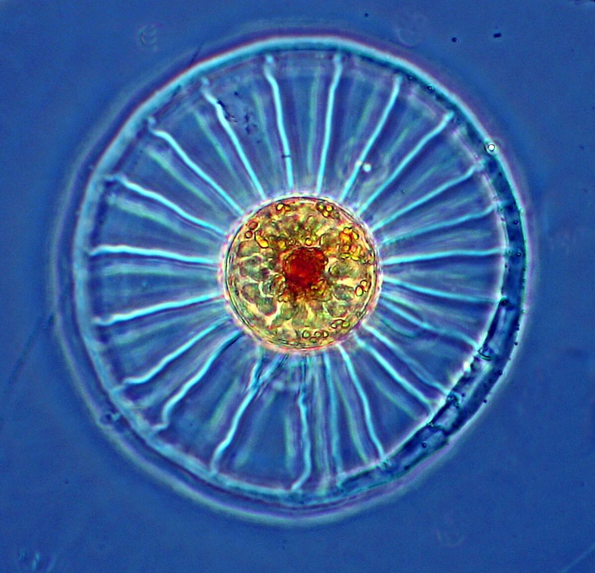 Wagon Wheel Diatom